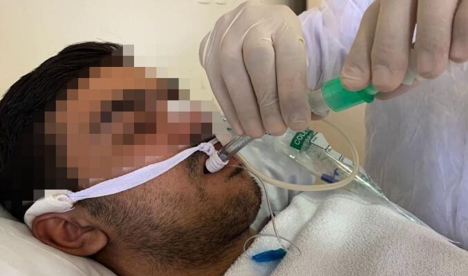 A sonda de sistema fechado de aspiração, utilizada frequentemente em pacientes em ventilação mecânica (Reprodução)