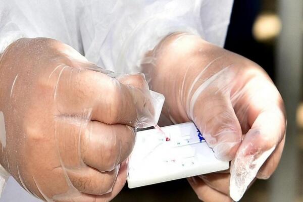 Mais de 600 testes rápidos foram realizados (Foto: Reprodução Agência Brasil)