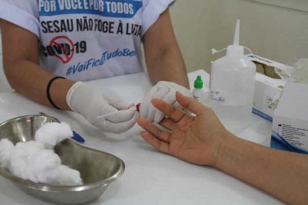 Ação faz parte da Campanha Por Você e Por Todos – a Sesau Não Foge à Luta (Foto: Divulgação)