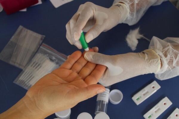 Resultado é proveniente de testes rápidos realizados nesta quarta (Foto: Secom-RR)