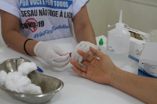 O Estado também contabilizou mais uma morte por covid nesta sexta (Foto: Divulgação)