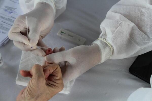 Resultado é proveniente principalmente de testes rápidos realizados nesta terça (Foto: Secom-RR)