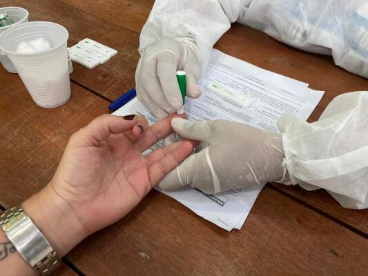 Resultado é proveniente principalmente de testes rápidos realizados nesta quarta (Foto: Secom-RR)