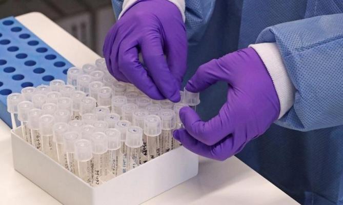 Os resultados são provenientes principalmente de 328 testes rápidos que tiveram resultado positivo nesta sexta-feira (Foto: Divulgação)