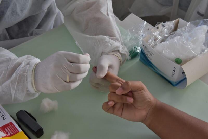 O Estado também contabiliza 661 óbitos por Coronavírus (Foto: Divulgação)