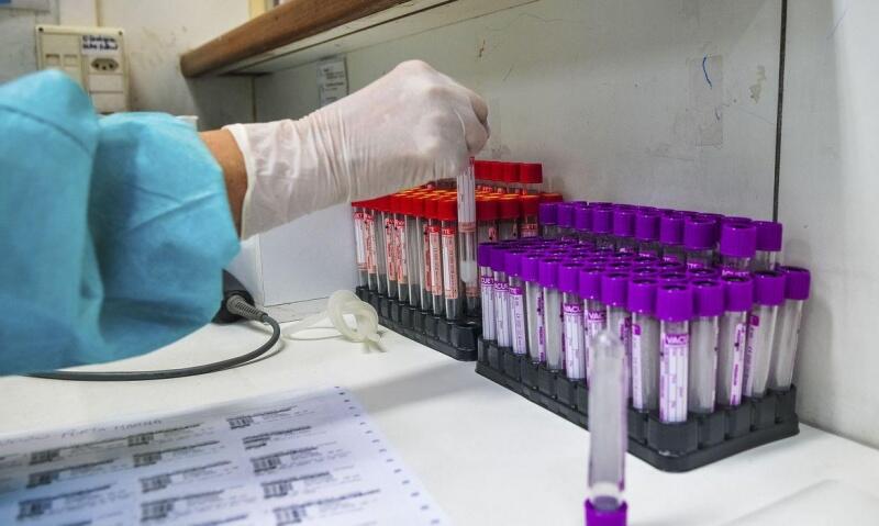 A investigação para verificar a eficácia da BCG também contra o novo coronavírus se baseia na hipótese de que países que mantém o uso da vacina apresentaram menor incidência de covid-19 (Foto: Divulgação)