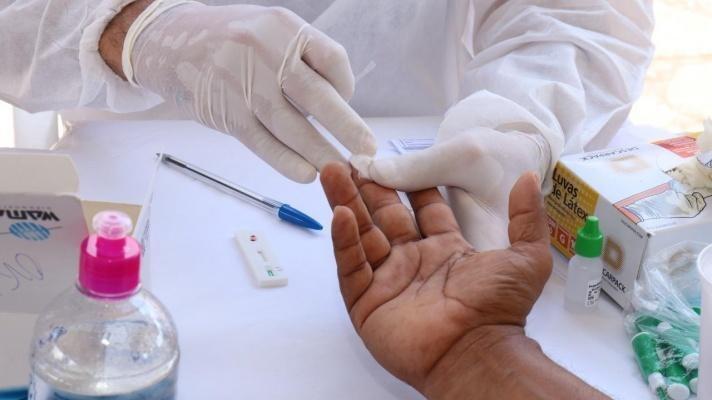 Roraima é o quarto estado com o maior percentual de pessoas que fizeram algum teste para diagnóstico do novo coronavírus (Foto: Nilzete Franco/FolhaBV)