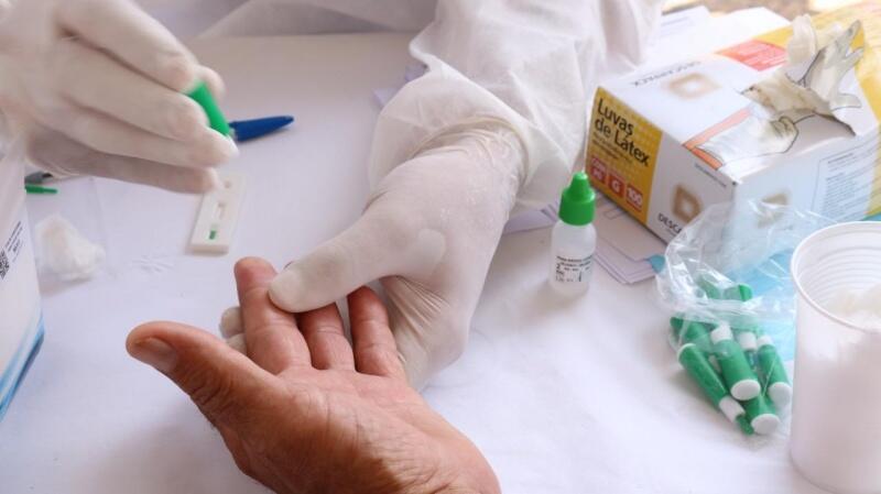 Casos confirmados são resultado de testes rápidos (Foto: Nilzete Franco/FolhaBV)