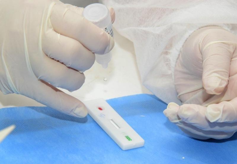 Os moradores buscaram saber a previsão de chegada de testes, mas não receberam resposta. (Foto: Divulgação)