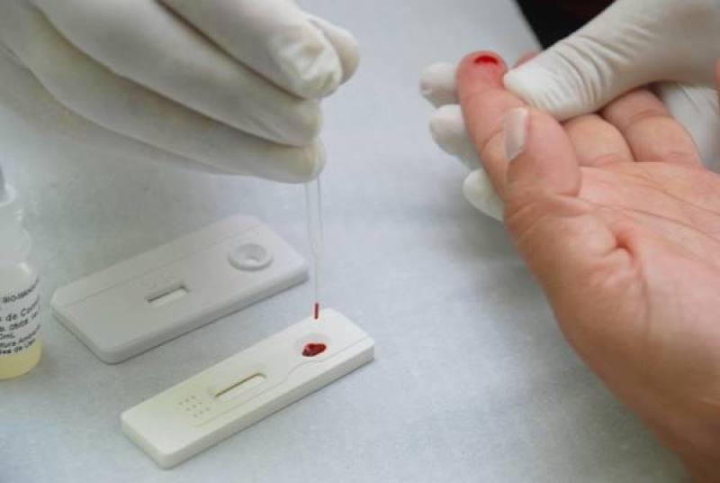 O Estado também contabiliza 755 óbitos, 11 a mais do que foi divulgado no sábado passado, 5. (Foto: Divulgação)