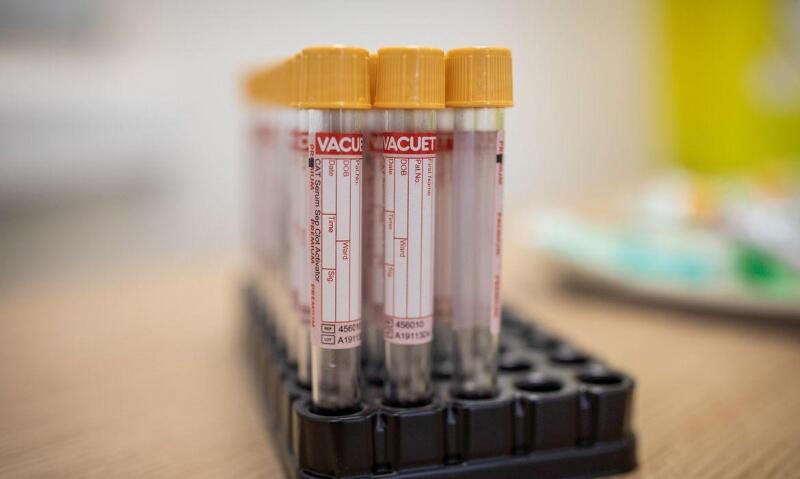 A nota recomenda que os laboratórios fiquem atentos às informações das instruções de uso de produtos existentes para a detecção de covid-19 (Foto: Divulgação)