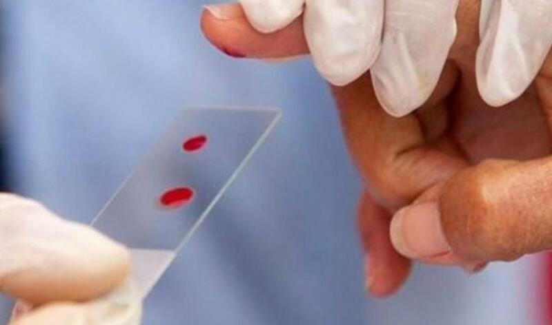 A hemofilia é um distúrbio genético e hereditário que atinge quase exclusivamente os homens (Foto: Divulgação)