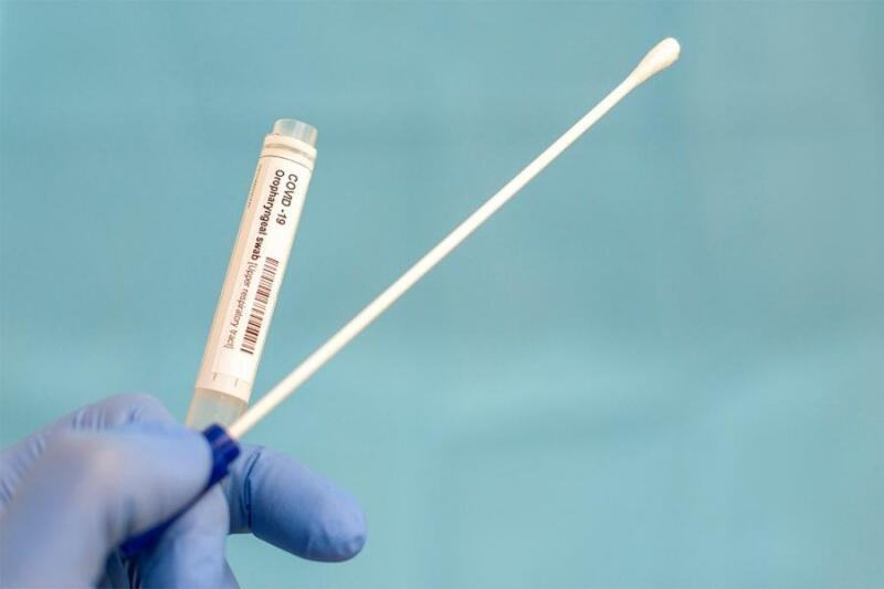 A norma atende à recomendação da Agência Nacional de Vigilância Sanitária (Anvisa), pelos riscos de contaminação e disseminação do vírus. (Foto: Divulgação)