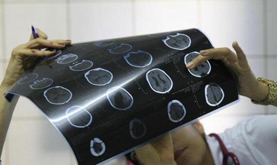 Maternidades de todo o País estão em alerta para casos de microcefalia (Foto: Guga Matos/Estadão)