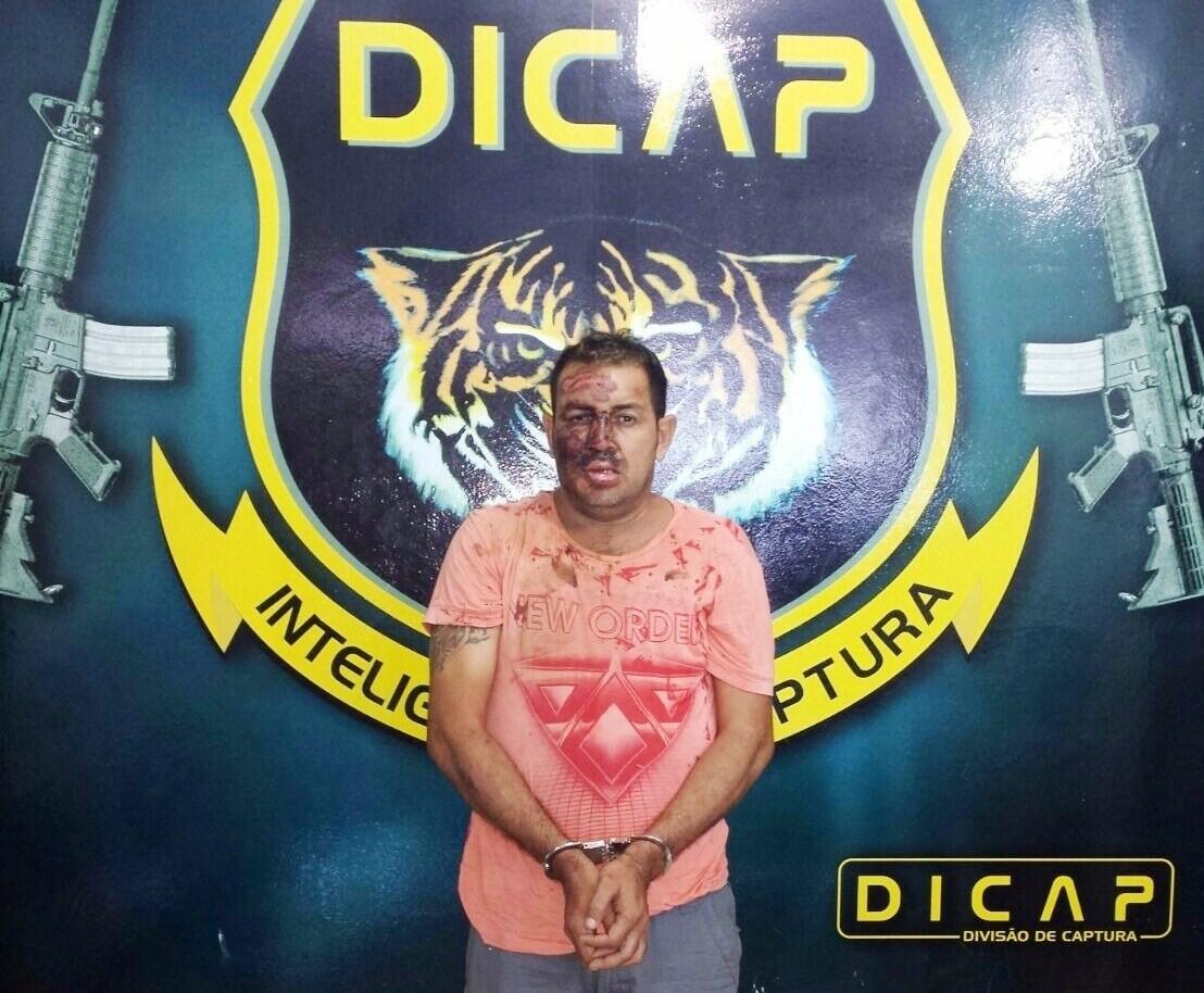 Mangulão foi reconhecido na manhã de sábado no Hospital Geral de Roraima (Foto: divulgação)