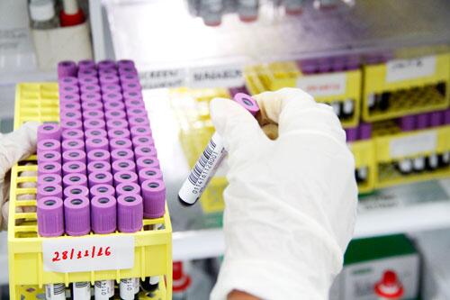 Em dez minutos, a pessoa tem o resultado de HIV com 99,9% fidedigno (Foto: Wenderson Cabral/FolhaBV)