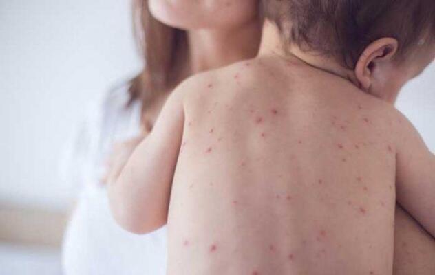 O controle da doença está sendo feito no estado para que o numero de casos permaneça reduzido (Foto: Divulgação)