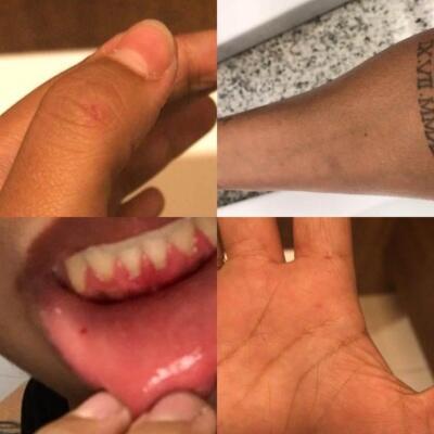 Uma das vítimas, a vendedora de 21 anos, teve escoriações pelo corpo (Foto: Arquivo Pessoal)