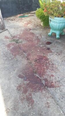 Parte do quintal da residência ficou coberto pelo sangue da aposentada que passar por cirurgia às pressas no hospital (Foto: Divulgação)