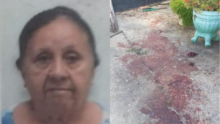 A aposentada Ana Maria Libório de Sá foi atacada no quintal de casa pelos cães da família (Foto: Arquivo Pessoal/Divulgação)