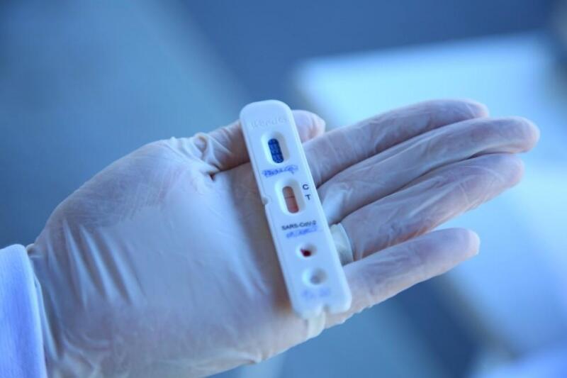A nova atualização do Boletim Epidemiológico do Estado contabiliza até o momento 76.043 casos confirmados para a COVID-19 (Foto: Divulgação)