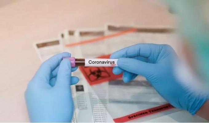 Além disso mais 358 casos novos para COVID-19 foram confirmados. (Foto: Divulgação)
