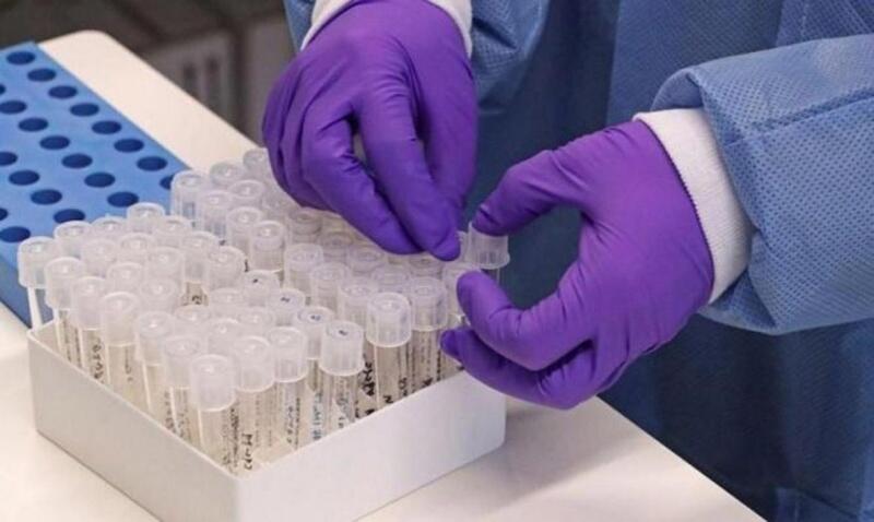 Com a contabilização destes dados, Roraima alcançou  marca de 82.217 casos confirmados e 1.114 mortes (Foto: Divulgação)