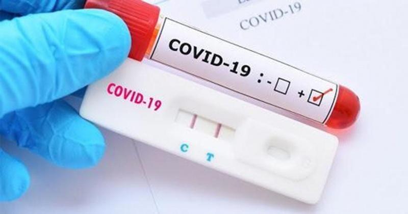 Foram liberados 63 exames com resultado positivo para a covid-19, sendo inseridos 924 testes rápidos no sistema com resultado também positivo (Foto: Divulgação)
