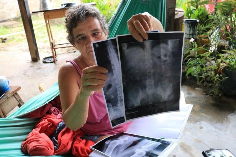 Marilene sofre com constantes dores por conta de pedras que estão nos seus rins (Foto: Diane Sampaio/FolhaBV)