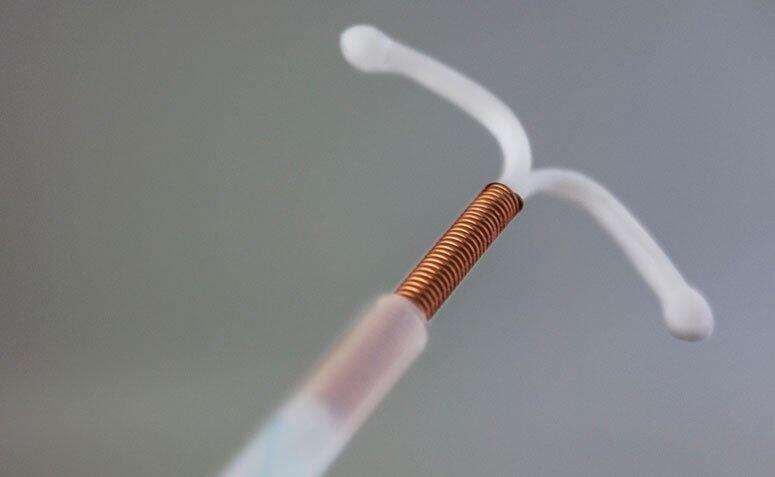 A aplicação do DIU pode ser feita em unidades privadas ou pelo SUS (Foto: Istock)