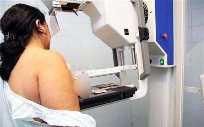 Mamografia é essencial para detectar alterações como o câncer de mama (Foto: Arquivo/Folha)