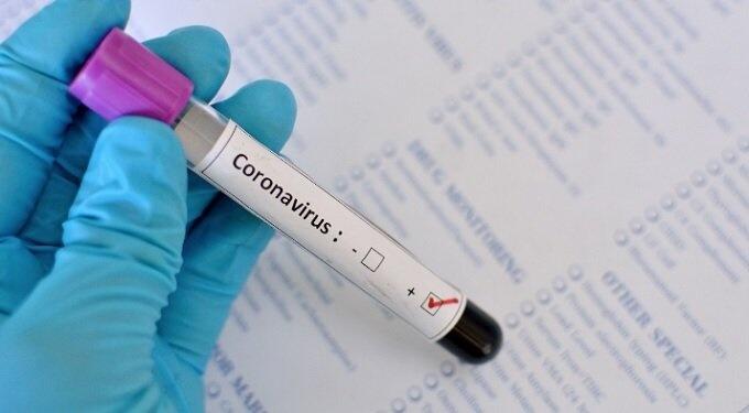 Testes positivos cresceram 67% (Foto: Divulgação)