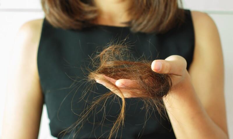 Quanto a procurar ou não um médico quando a queda de cabelo fica evidente, o especialista salienta que um diagnóstico correto da causa é fator fundamental para contextualizar o tratamento junto ao paciente. (Foto: Divulgação)