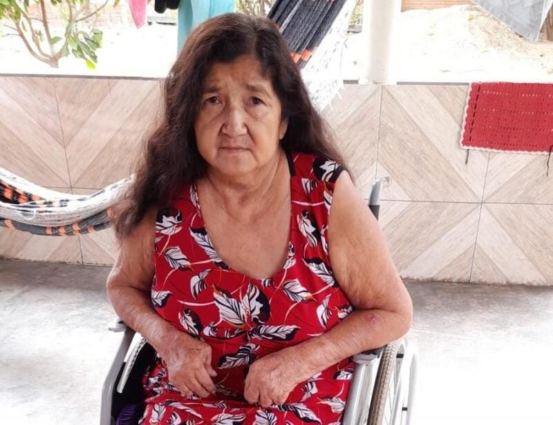 Aguardando cirurgia, ela contou as dificuldades que enfrenta para se locomover nos últimos 4 anos (Foto: Arquivo pessoal)