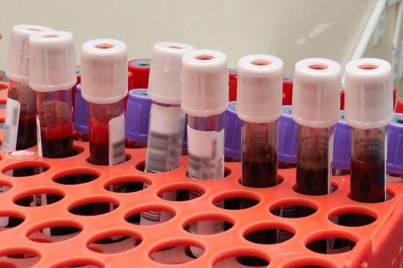 Especialistas notaram também que muitas crianças tinham tido covid-19 antes da hepatite aguda. Um estudo publicado na Lancet na semana passada propôs, então, nova hipótese. Segundo o trabalho, uma combinação entre as duas infecções estaria provocando a doença hepática aguda. (Foto: Nilzete Franco/FolhaBV)
