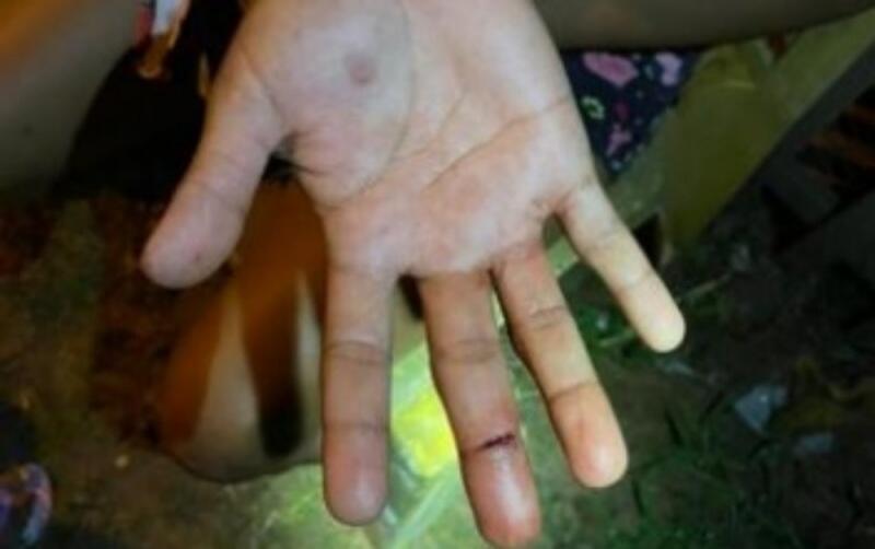 Marcas de corte no dedo médio da vítima (Foto: Divulgação)