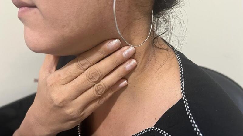 O câncer se caracteriza pelo crescimento acelerado das células não saudáveis no sistema linfático (Foto:Ascom/Sesau)