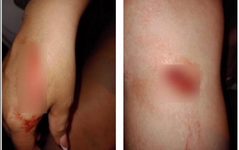 Os golpes atingiram a mão e abaixo do joelho direito da vítima (Foto: Divulgação)
