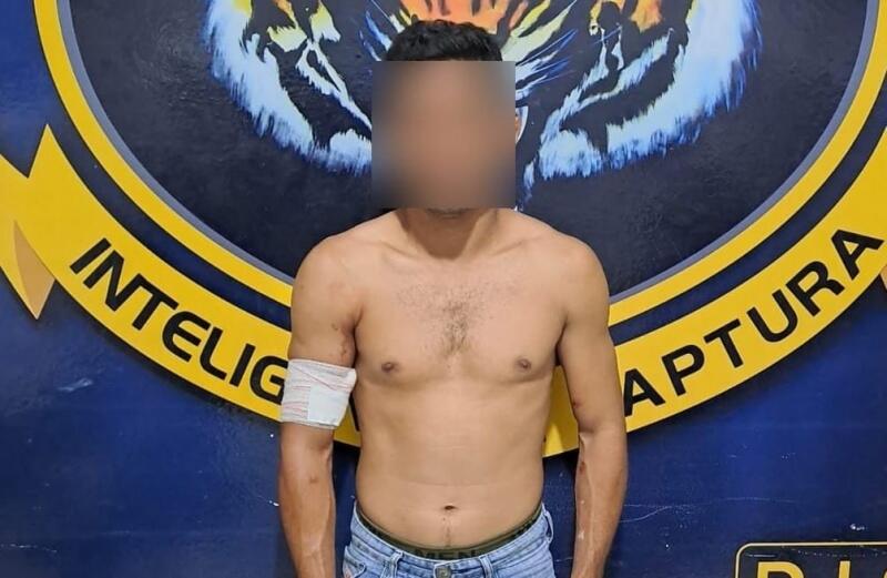 J.C.S. foi atingido por um disparo de arma de fogo. O projetil ficou alojado no antebraço esquerdo (Foto: Divulgação)