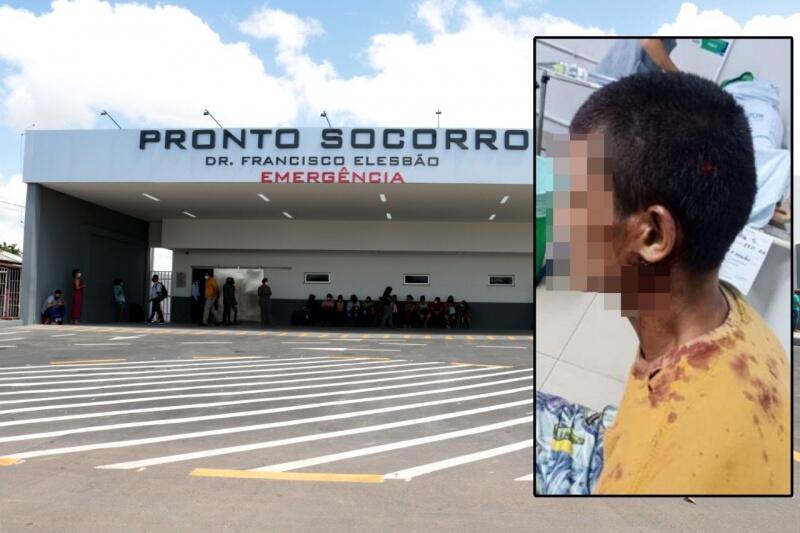 Por conta dos ferimentos, o suspeito foi encaminhado ao HGR e em seguida, a Central de Flagrantes (Foto: Divulgação)