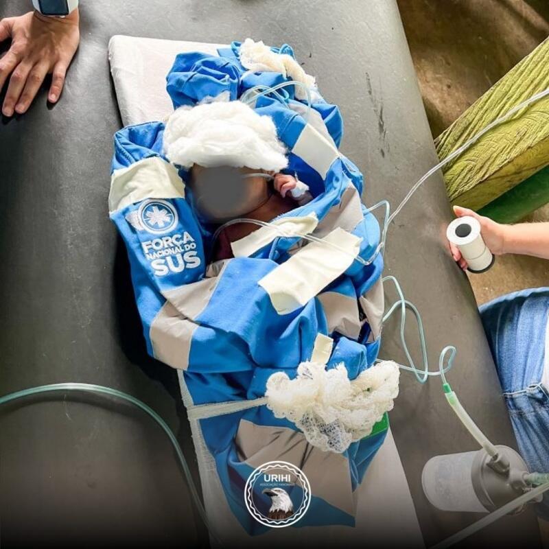 Recém-nascido foi transferido para a UTI da Maternidade Nossa Senhora de Nazareth - Foto: Divulgação/Instagram/urihiyanomami