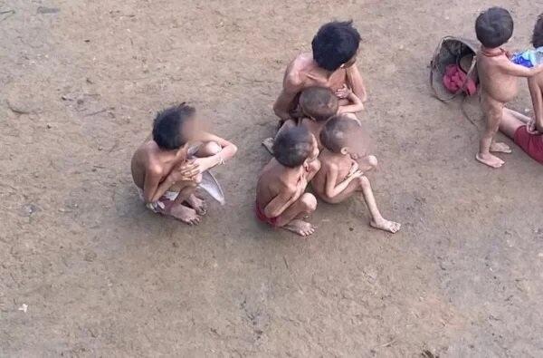 Crianças e adultos sofrem com a desnutrição (Foto: Reprodução/Instagram/urihiyanomami)