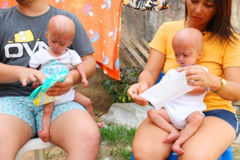 Elis e Eloá moram com a mãe e os irmãos em um cômodo dividido entre cozinha e quarto (Foto: Wenderson Cabral)